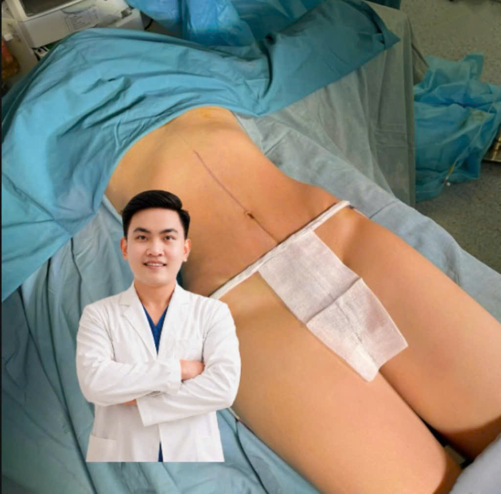 Phẫu thuật thực tế 6