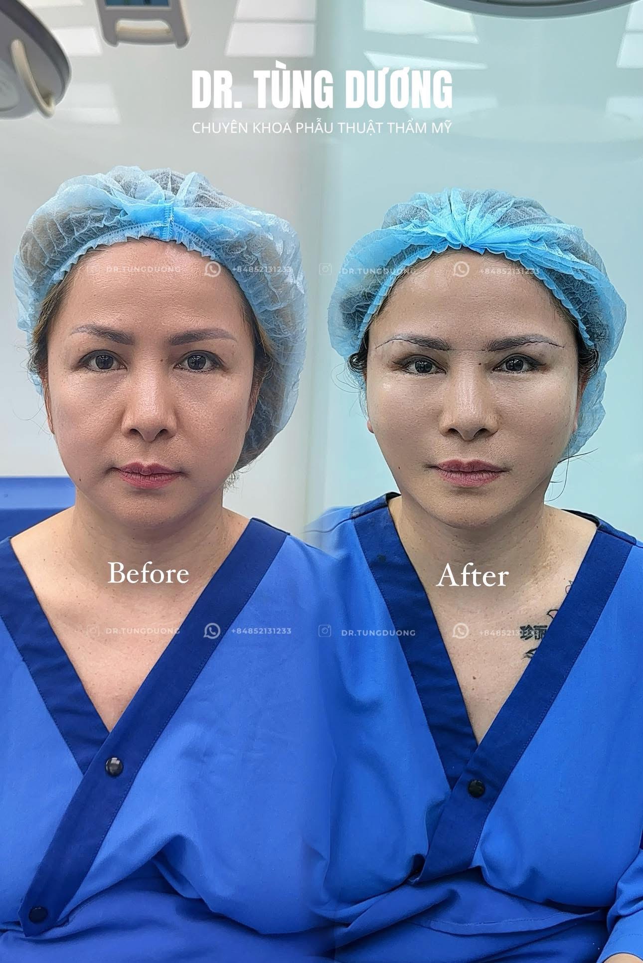 Phẫu thuật thực tế 2