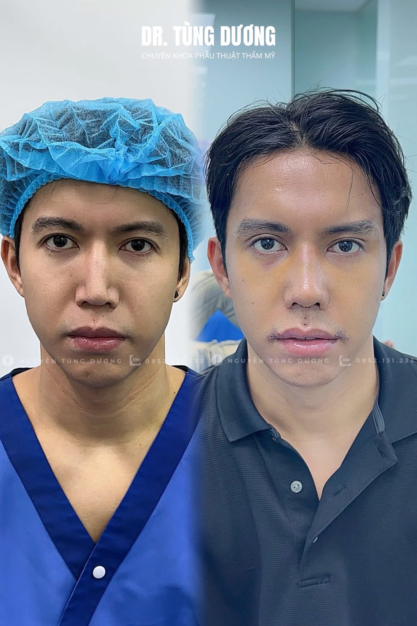 Phẫu thuật thực tế 3