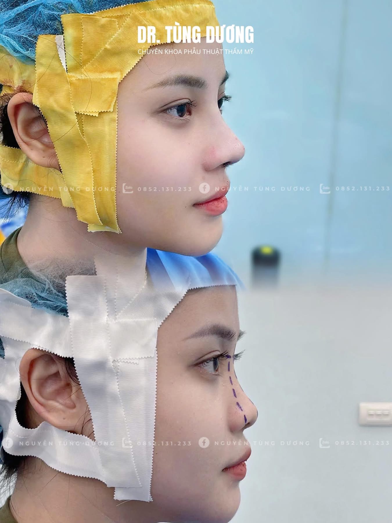 Phẫu thuật thực tế 6